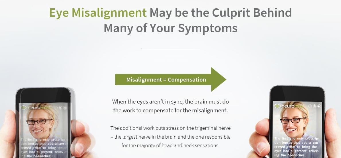 Neurolens -Trigeminal Nerve